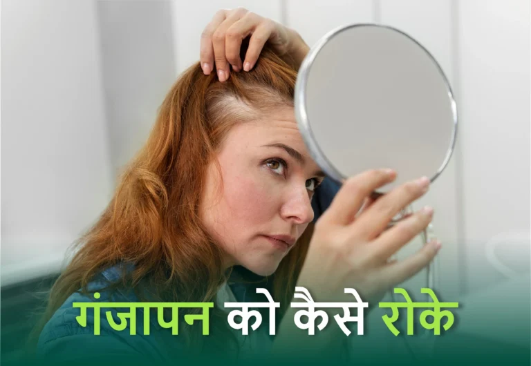 How to Stop Hair Fall at home in hindi
